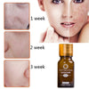 Natural Acne Removal Scar Oil